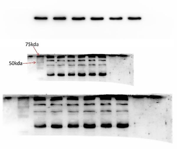 Anti-GRK5 Antibody