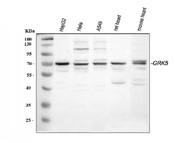 Anti-GRK5 Antibody