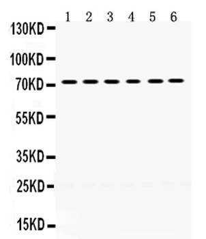 LIM kinase 2/LIMK2 Rabbit Polyclonal Antibody