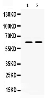Anti-LOXL1 Antibody