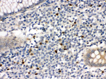 MMP8 Rabbit Polyclonal Antibody