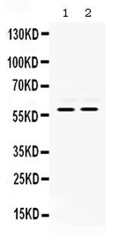 MMP8 Rabbit Polyclonal Antibody