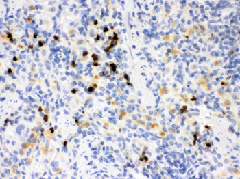 Anti-MMP8 Antibody