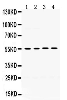 Anti-MMP8 Antibody