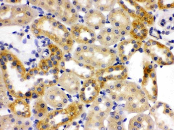 Anti-OPA1 Antibody