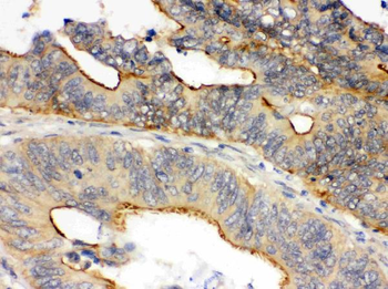 Oncostatin M/OSM Rabbit Polyclonal Antibody