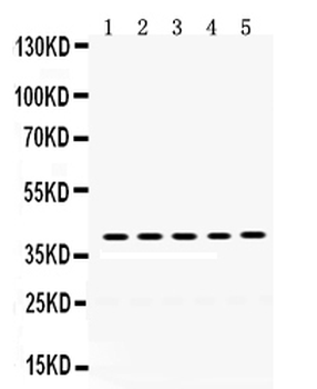 Anti-Oncostatin M/OSM Antibody