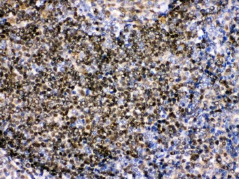 Anti-Pax2 Antibody