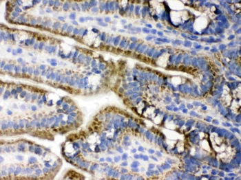 Anti-PDPK1 Antibody