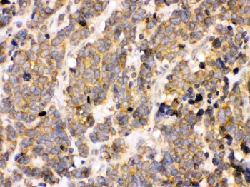 Anti-PDPK1 Antibody