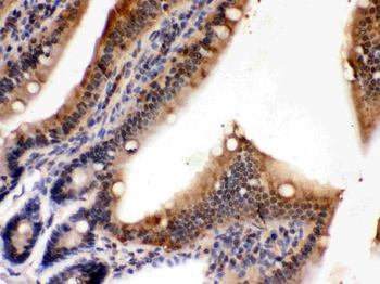 Anti-PDPK1 Antibody
