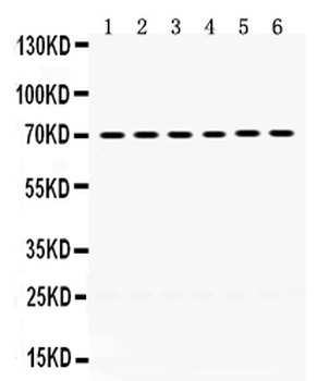 Anti-PDPK1 Antibody