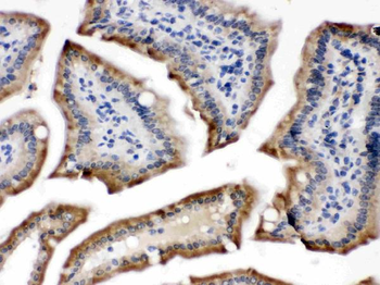 Anti-Cytochrome P450 Reductase/POR Antibody
