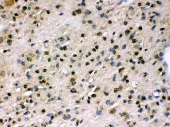 Anti-Myosin Phosphatase/PPP1R12A Antibody