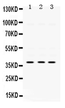 Anti-AMPK beta 1/PRKAB1 Antibody