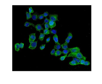 Anti-AMPK beta 2/PRKAB2 Antibody