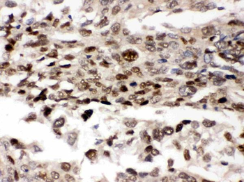 Anti-AMPK beta 2/PRKAB2 Antibody