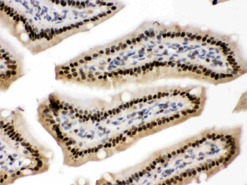 Anti-AMPK beta 2/PRKAB2 Antibody