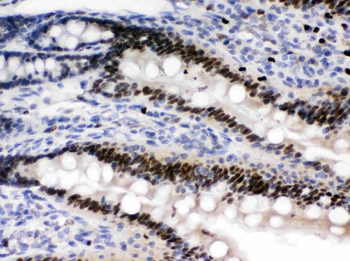 Anti-AMPK beta 2/PRKAB2 Antibody