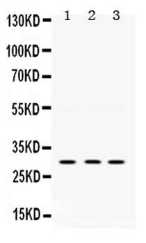 Anti-AMPK beta 2/PRKAB2 Antibody