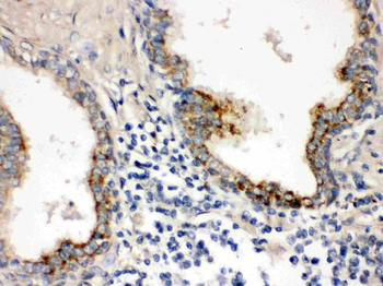 Anti-PTP4A2 Antibody