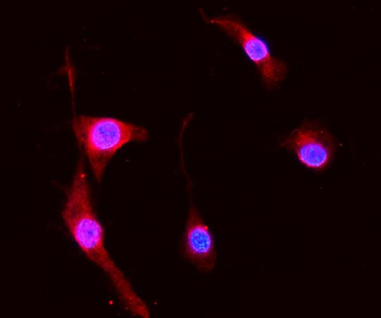 Anti-MRP8/S100A8 Antibody