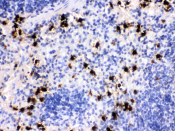 Anti-MRP8/S100A8 Antibody