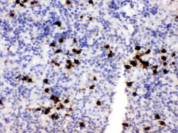 Anti-MRP8/S100A8 Antibody