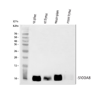 Anti-MRP8/S100A8 Antibody