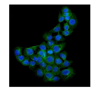 Anti-Syndecan-1/SDC1 Antibody