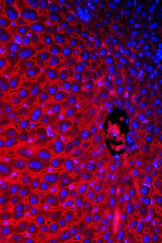 Anti-SLC10A1 Antibody
