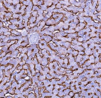 Anti-SLC10A1 Antibody