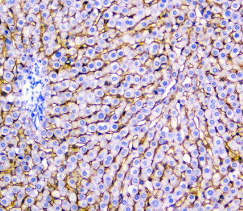 Anti-SLC10A1 Antibody