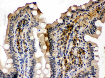 Anti-SMC3 Antibody