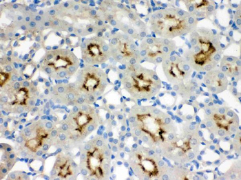 Anti-SMC3 Antibody