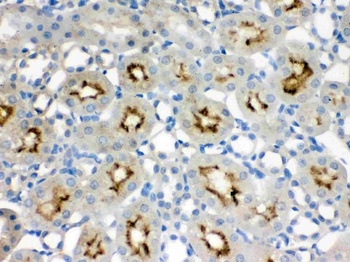 SMC3 Antibody