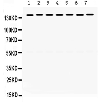 Anti-SMC3 Antibody