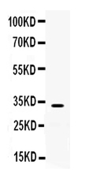 TREX1 Rabbit Polyclonal Antibody