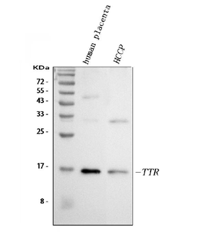 Anti-Prealbumin/TTR Antibody