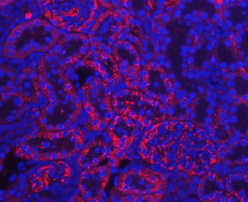 Anti-Prealbumin/TTR Antibody