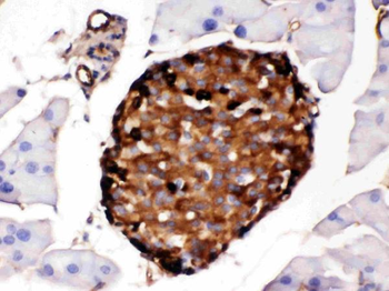 Anti-Prealbumin/TTR Antibody