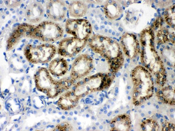 Anti-Prealbumin/TTR Antibody
