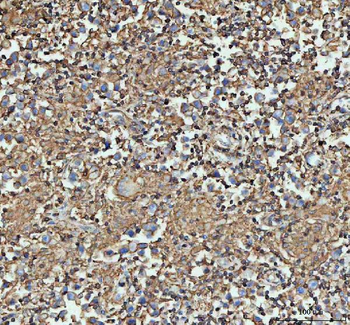 Anti-Actin/ACTA1 Antibody