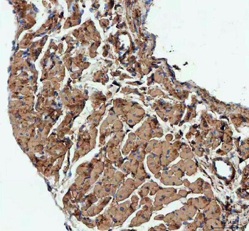 Anti-Actin/ACTA1 Antibody