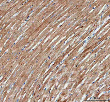 Anti-Actin/ACTA1 Antibody