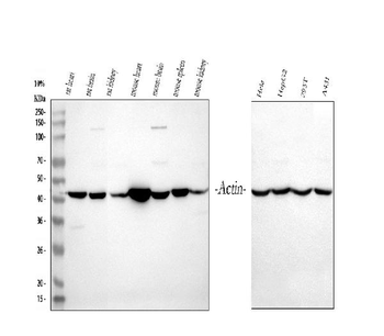 Anti-Actin/ACTA1 Antibody