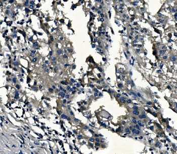 Anti-alpha 1d Adrenergic Receptor/ADRA1A Antibody