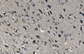 Anti-alpha 1d Adrenergic Receptor/ADRA1A Antibody