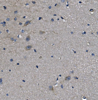 Anti-alpha 1d Adrenergic Receptor/ADRA1A Antibody