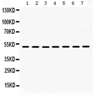 Anti-alpha 1d Adrenergic Receptor/ADRA1A Antibody